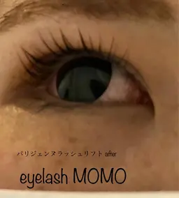 バインドロック　90束