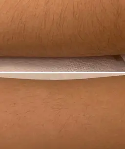 ジュニア脱毛（小、中学生）腕上下+脚上下