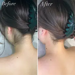 【シェービング】本格うなじシェービング♡ 大事な日の前に✨整ったうなじ✨