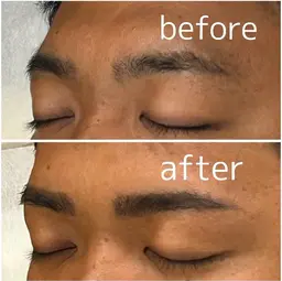 【眉癖改善】ハリウッドブロウリフト