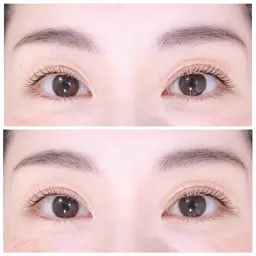 ラッシュリフト(上のみ)🥥