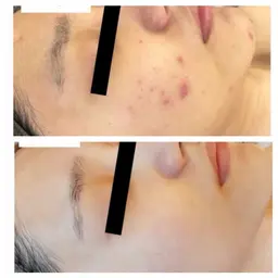 【初回限定】オルちゃん肌に憧れる方へ！目指せ陶器肌プログラム体験