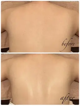 ⭐️ミニモ限定　背中オイルマッサージ付き⭐️脱離なし★背中ピーリング＆美白パック　背面美人コース50分　¥5500