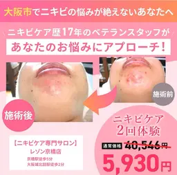 《人気No.1》リピート率90％以上！本気のニキビ対策！ニキビ跡にも◎ニキビケア/フェイシャル２回体験