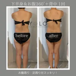 【モニター様 3名募集】筋膜リリース⭐️痩身エステ(上半身or下半身) 60分×4回