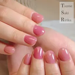 深爪矯正┋ワンカラー