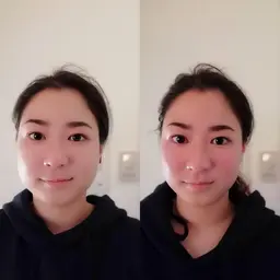 【人気No.１👑】小顔になれる美容鍼《プレミアム美顔コース》▷美顔鍼100本（パルス付）▷姿勢矯正▷美顔矯正▷小顔調整