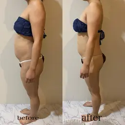 県内初導入✨効果すごい!キャビテーション痩せたい方必見