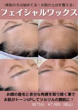 《顔脱毛＆角質ケア✨》フェイシャルワックス＋保湿パック✨