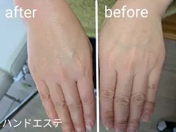 【手元ふっくら】極上ハンドエステ✨パラフィンパック付