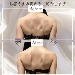 【駆け込みブライダル💍】ボディハイパーナイフ+ボディコルギ+フェイシャルハイパーナイフ+EMS