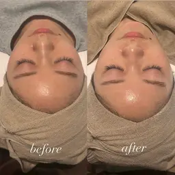 【肌質改善】クリスティーナ ビオフィートシリーズ ハーブピーリング🌿