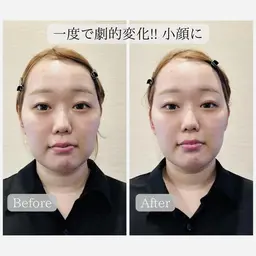 🌟人気NO.1🌟【骨格から美眉毛に💎🫧】小顔矯正＆美眉WAXスタイリング＆バブル保湿パック 仙台/あおば通駅