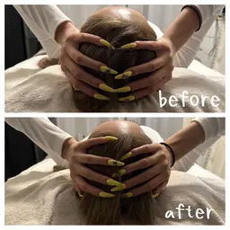 【すぐ効果実感💎】小顔矯正×頭蓋骨矯正フル施術💆通常価格22000円→体験価格3300円