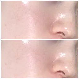 【韓国肌管理✨️最新第四世代ピーリング】 ララピール￥9300