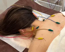 鍼通電施術お試しキャンペーン❤️眼精疲労、頭痛、首、肩こり・腰痛、足疲労が気になる方❤️