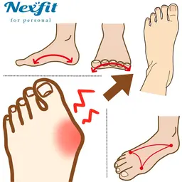 【外反母趾】オールハンド筋膜リリースによる《外反母趾改善施術》の撮影モデルさん募集！