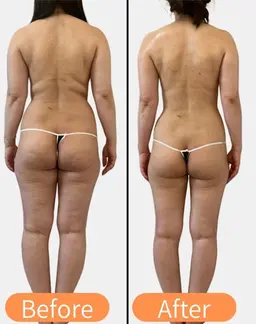 【メリハリ美ボディに◉】キャビテーション&ラジオ波&EMS &発汗デトックス90分