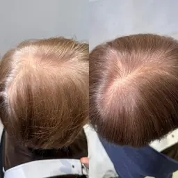 【一ヶ月以内でご来店の方⏰根本のメンテナンス🔨】脱白髪染めイルミナ系リタッチカラー+選べる5stepトリートメント🌟