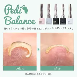 【巻き爪でお悩みの方へ】巻き爪ケア✨❗️¥11,000→¥500⚠️オフありの場合メッセージ必須⚠️