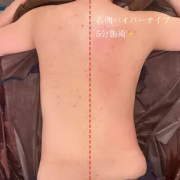 結果重視の痩身！ハイパーナイフ半身（上半身or下半身）