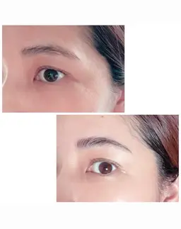 話題のハリウッドブロウリフト＋ワックス脱毛