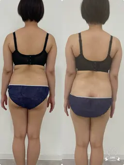 ブライダルエステ上半身コース