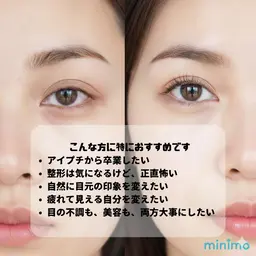 【30名限定モニター】目元の悩み、全部ここから! 目がぱっちり見える目元集中ケア ¥7,700 →無料モデル