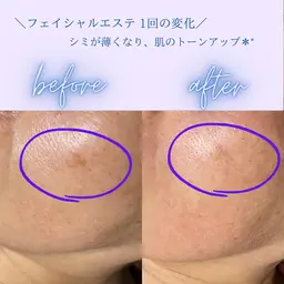 《潤いとトーンアップ✨》フェイシャルエステ