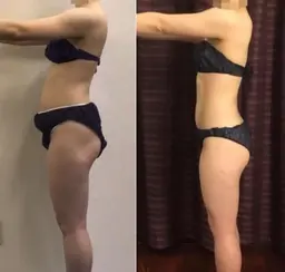 リバウンドなし 夏までに食べ痩せ痩身キャビ