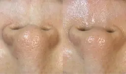 【お試し】部分ワックス　鼻