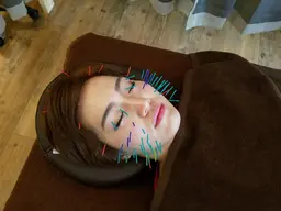 100本　小顔美容鍼　70分