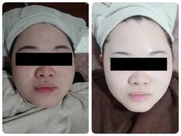 【フェイシャル】やわらかふっくらなお肌へ💆‍♀️✨