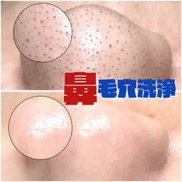 【全顔】毛穴洗浄🩵✨︎⏰60分