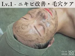 【学割U24】剥離ありハーブピーリング[剥離なし約10回分の効果]¥25,175