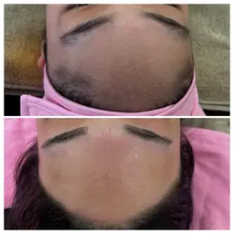 顔シュガーリング