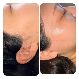 メンズもレディースも🉑！艶肌フェイスワックス【全顔】＋鎮静パック