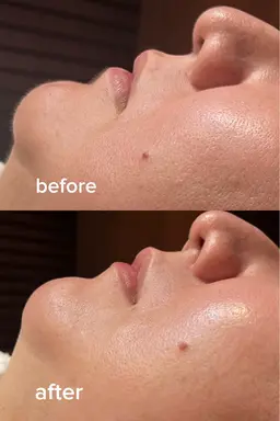 2/7.11.14限定です。👩✨💓レディースシェービング💓✨👩お顔と襟足のメニューです。