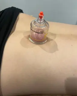 ✨カッピング⭐️ 全身