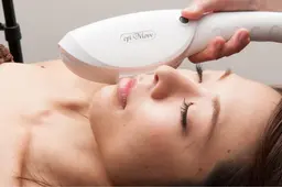 顔脱毛⭐️産毛も綺麗に脱毛‼︎