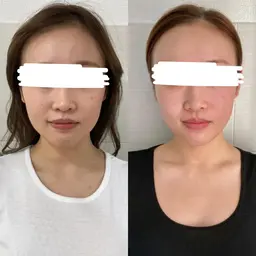 ✨学割U24✨プロの美容整体❗左右差/猫背/巻き肩/肩幅/全身/二の腕/エラ張【小顔矯正＋骨盤矯正＋頭蓋骨矯正】 90分