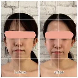 【小顔矯正フェイシャル】60分パック付き