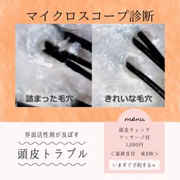 【髪・頭皮のお悩み】頭皮マイクロスコープ診断(頭皮マッサージ＆マイクロスコープ込)