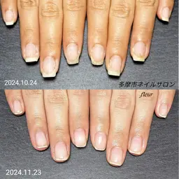 地爪育成(ジェル)オフ別途