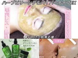【最強小顔&艶肌】ハーブピーリング×ハイパーナイフEX小顔70分15000→9800