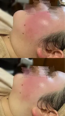 【手触り🆙✨️】フェイスシェービング