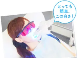 歯のセルフホワイトニング2回目の方✨