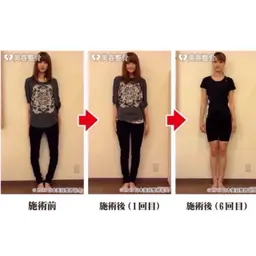 【メンズok】猫背肩こり/肩こり、首こりに全身姿勢矯正!歪みを整え、筋疲労にアプローチ