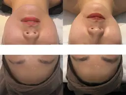 ​〜​フェイスラインがスッキリする！自分の理想の顔になれます​〜​小顔コルギ