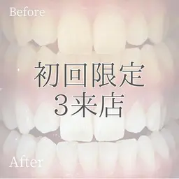 【ミニモ限定✨】3来店チケット通常¥20,940→¥12,000👀ホワイトニングの良さを知ってください❗️